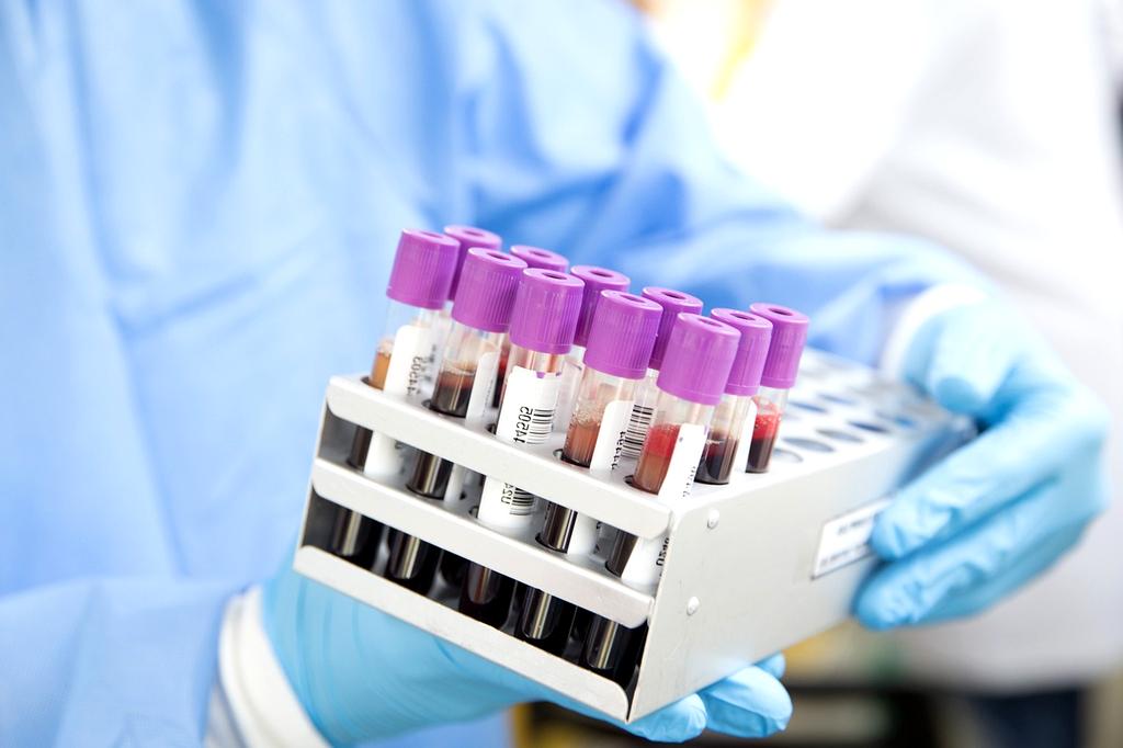 Laboratory analysis of water samples